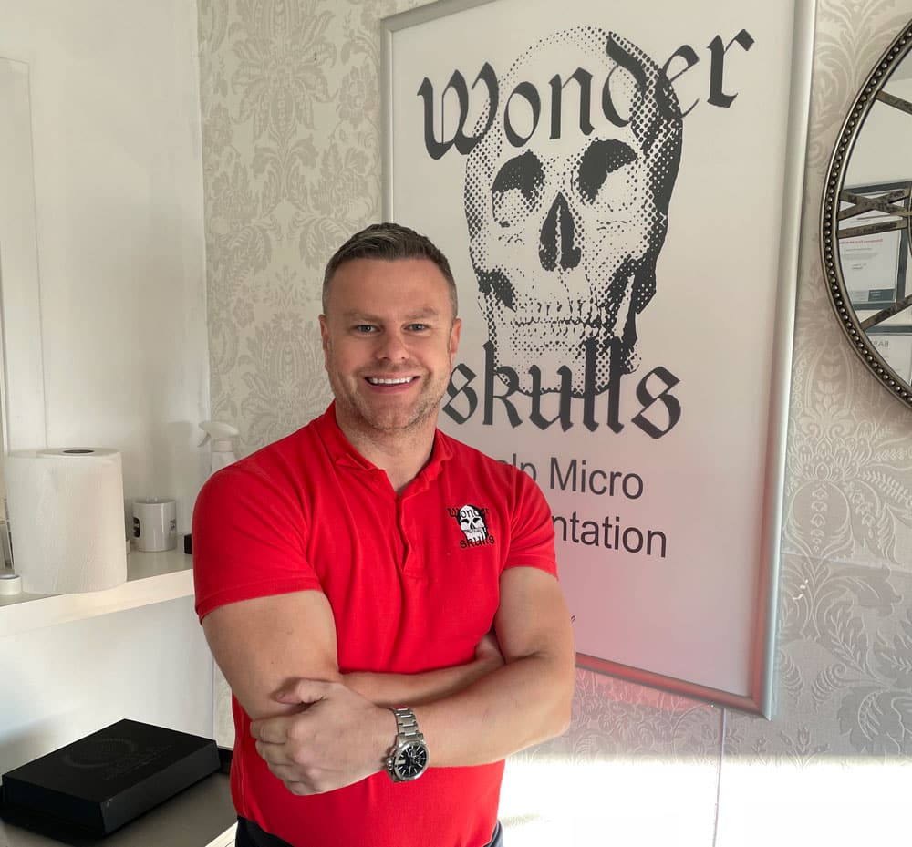 Scalp Micropigmentation, Glasgow